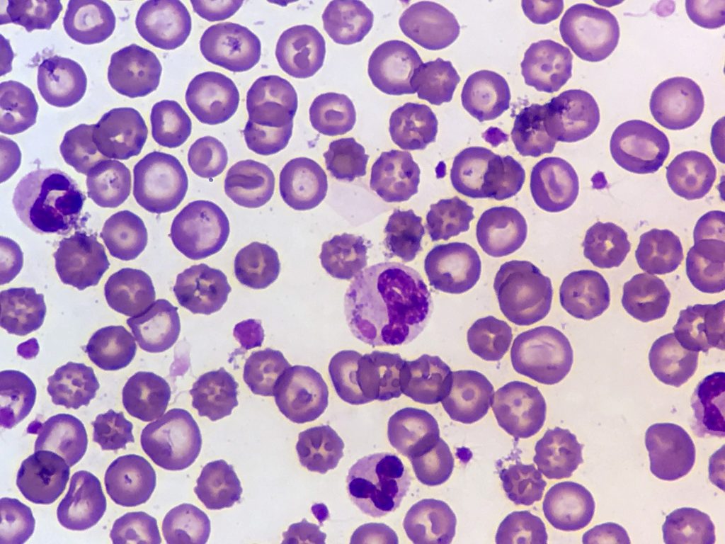 Anemia en perros: causas y señales de alarma